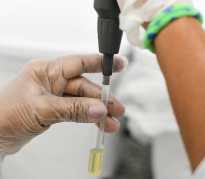 Marco Antônio / Ascom Sesau