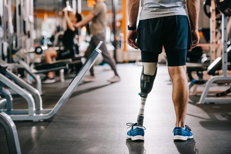 Homem com prótese na perna esquerda está de costas em uma academia, usando camiseta cinza, bermuda preta e tênis azuis. Ao fundo, outras pessoas se exercitam em aparelhos, em ambiente amplo e iluminado.